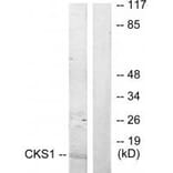 Western blot - CKS1 Antibody from Signalway Antibody (33830) - Antibodies.com