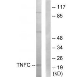 Western blot - TNFC Antibody from Signalway Antibody (33861) - Antibodies.com