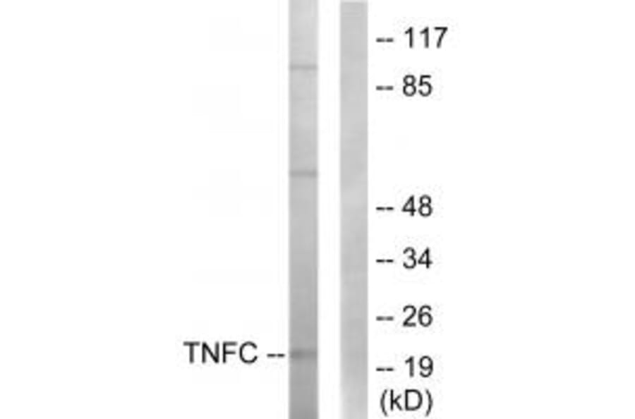 Western blot - TNFC Antibody from Signalway Antibody (33861) - Antibodies.com