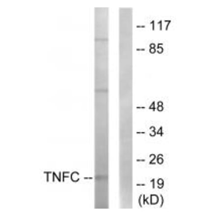 Western blot - TNFC Antibody from Signalway Antibody (33861) - Antibodies.com