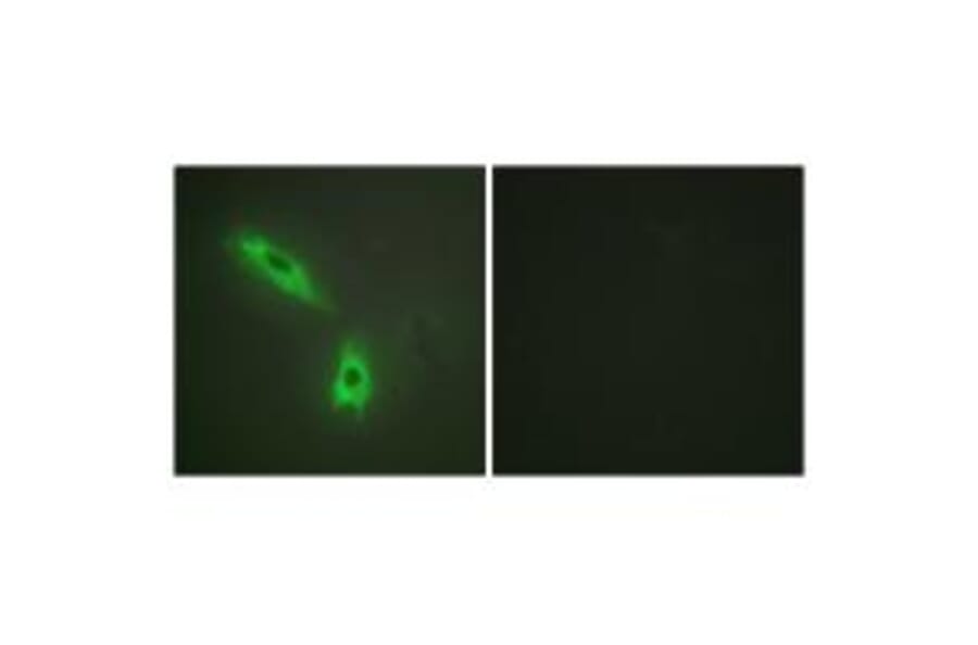 Immunofluorescence - TNFC Antibody from Signalway Antibody (33861) - Antibodies.com