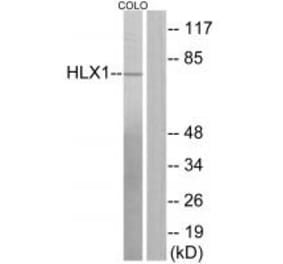 Western blot - HLX1 Antibody from Signalway Antibody (33884) - Antibodies.com