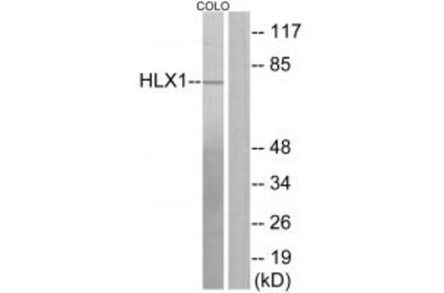 Western blot - HLX1 Antibody from Signalway Antibody (33884) - Antibodies.com