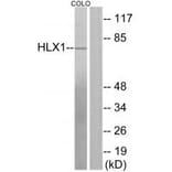 Western blot - HLX1 Antibody from Signalway Antibody (33884) - Antibodies.com
