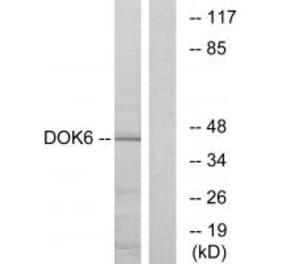 Western blot - DOK6 Antibody from Signalway Antibody (33939) - Antibodies.com