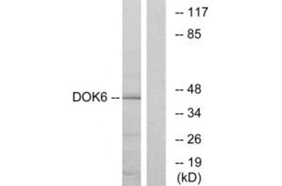 Western blot - DOK6 Antibody from Signalway Antibody (33939) - Antibodies.com