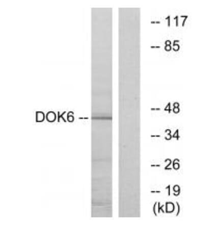 Western blot - DOK6 Antibody from Signalway Antibody (33939) - Antibodies.com