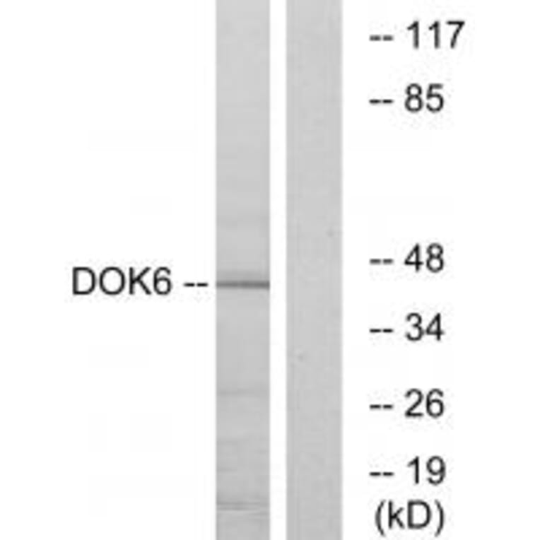 Western blot - DOK6 Antibody from Signalway Antibody (33939) - Antibodies.com