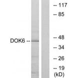 Western blot - DOK6 Antibody from Signalway Antibody (33939) - Antibodies.com