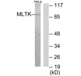 Western blot - MLTK Antibody from Signalway Antibody (34083) - Antibodies.com