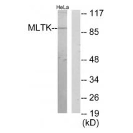Western blot - MLTK Antibody from Signalway Antibody (34083) - Antibodies.com