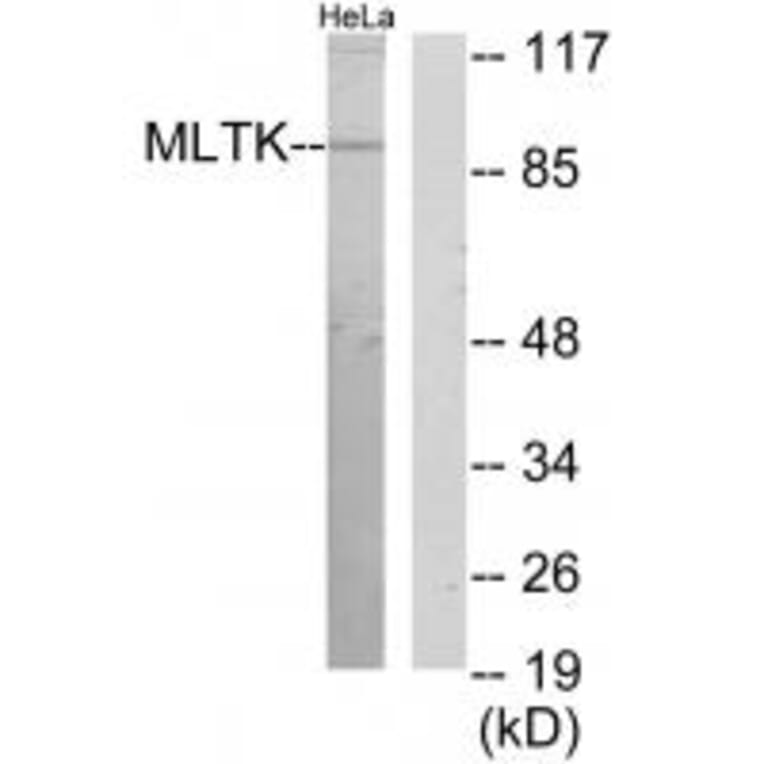 Western blot - MLTK Antibody from Signalway Antibody (34083) - Antibodies.com