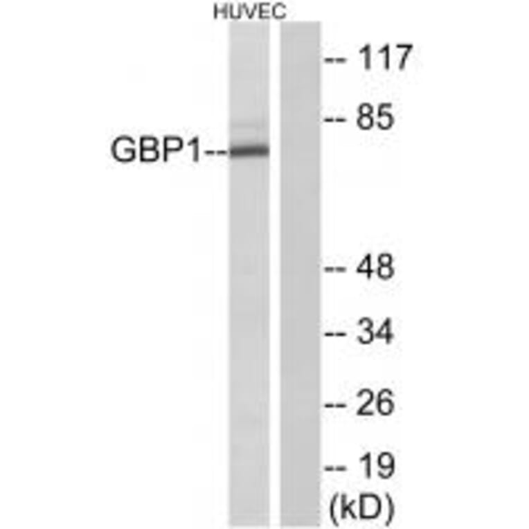 Western blot - GBP1 Antibody from Signalway Antibody (34250) - Antibodies.com