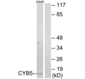 Western blot - CYB5 Antibody from Signalway Antibody (34264) - Antibodies.com