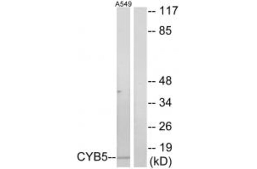 Western blot - CYB5 Antibody from Signalway Antibody (34264) - Antibodies.com