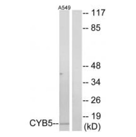 Western blot - CYB5 Antibody from Signalway Antibody (34264) - Antibodies.com