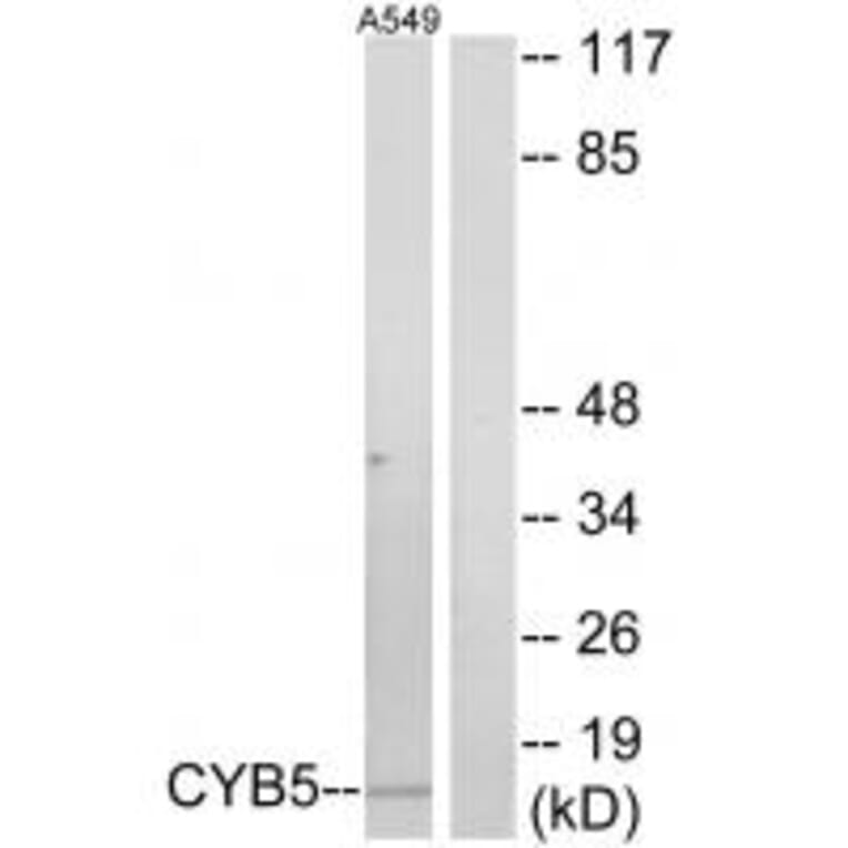 Western blot - CYB5 Antibody from Signalway Antibody (34264) - Antibodies.com