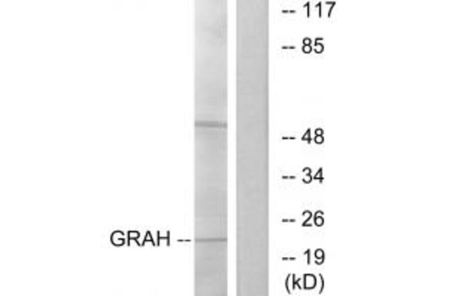 Western blot - GRAH Antibody from Signalway Antibody (34271) - Antibodies.com