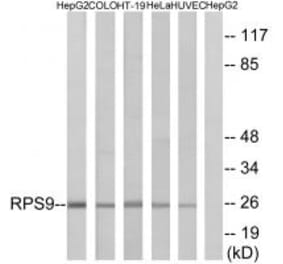Western blot - RPS9 Antibody from Signalway Antibody (34341) - Antibodies.com