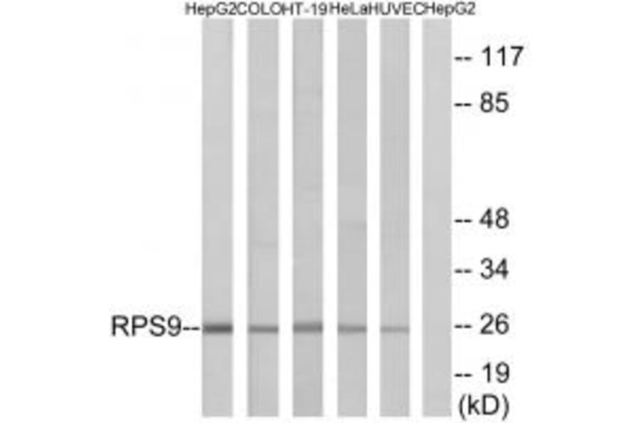 Western blot - RPS9 Antibody from Signalway Antibody (34341) - Antibodies.com