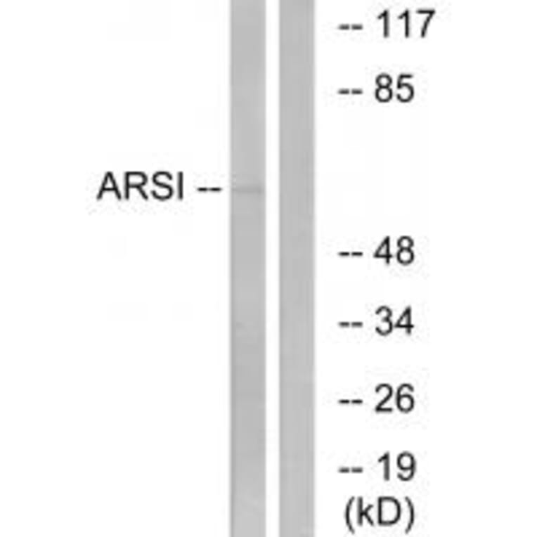 Western blot - ARSI Antibody from Signalway Antibody (34444) - Antibodies.com