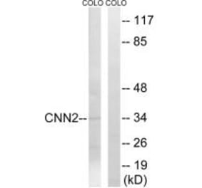 Western blot - CNN2 Antibody from Signalway Antibody (34522) - Antibodies.com