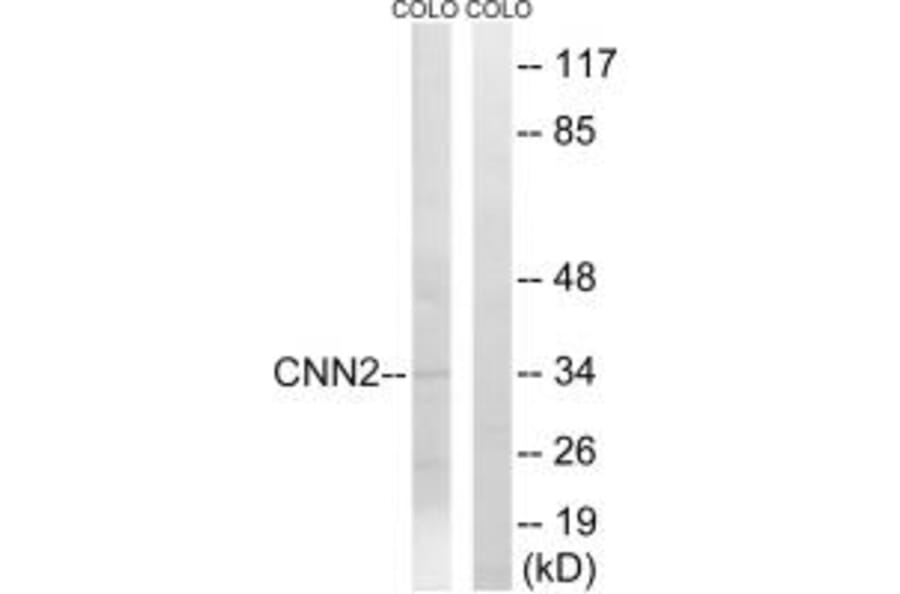 Western blot - CNN2 Antibody from Signalway Antibody (34522) - Antibodies.com
