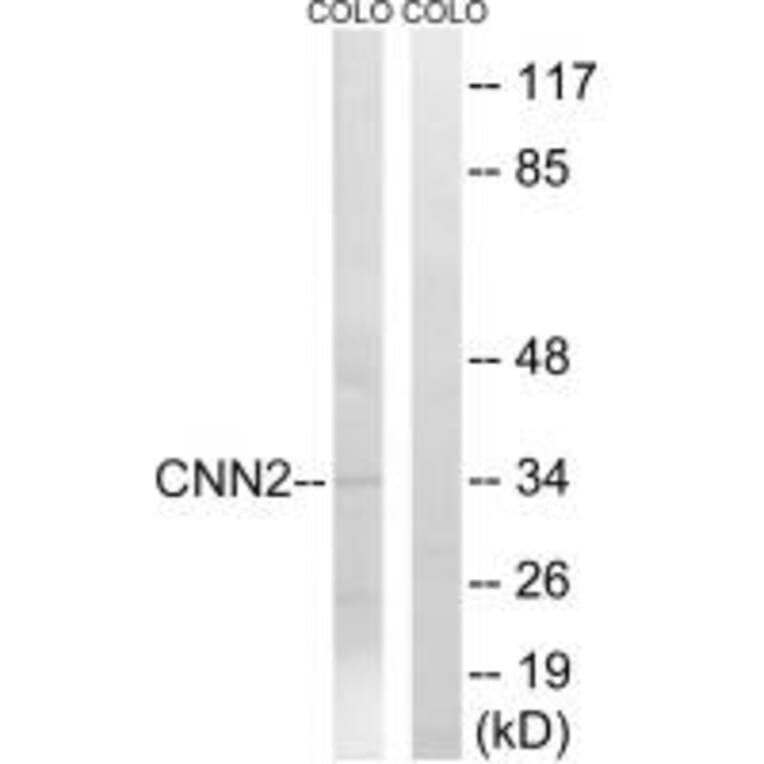 Western blot - CNN2 Antibody from Signalway Antibody (34522) - Antibodies.com