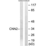 Western blot - CNN2 Antibody from Signalway Antibody (34522) - Antibodies.com