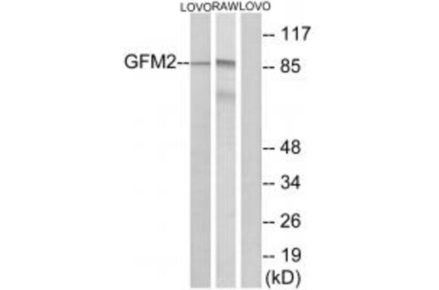Western blot - GFM2 Antibody from Signalway Antibody (34668) - Antibodies.com