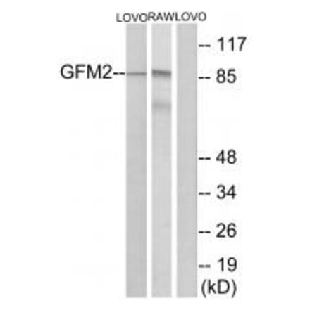 Western blot - GFM2 Antibody from Signalway Antibody (34668) - Antibodies.com