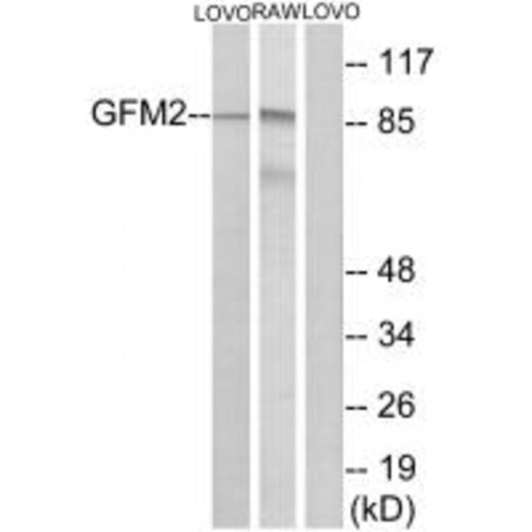 Western blot - GFM2 Antibody from Signalway Antibody (34668) - Antibodies.com