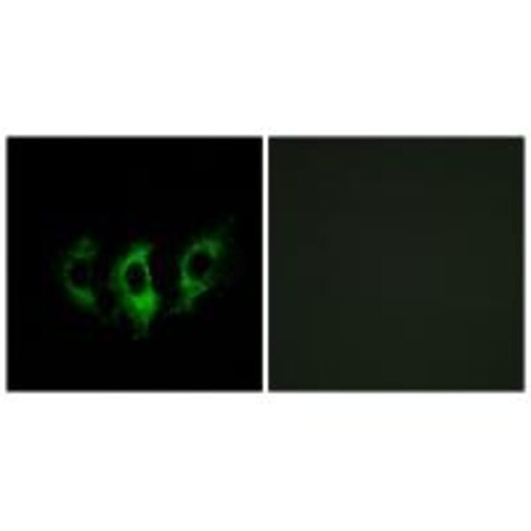 Immunofluorescence - GFM2 Antibody from Signalway Antibody (34668) - Antibodies.com