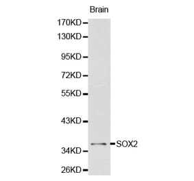 Western blot - SOX2 antibody from Signalway Antibody (38134) - Antibodies.com