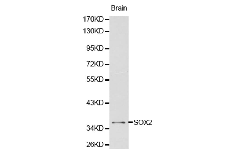 Western blot - SOX2 antibody from Signalway Antibody (38134) - Antibodies.com