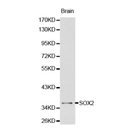 Western blot - SOX2 antibody from Signalway Antibody (38134) - Antibodies.com