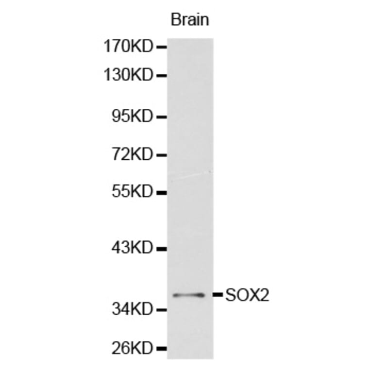 Western blot - SOX2 antibody from Signalway Antibody (38134) - Antibodies.com