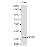 Western blot - SOX2 antibody from Signalway Antibody (38134) - Antibodies.com