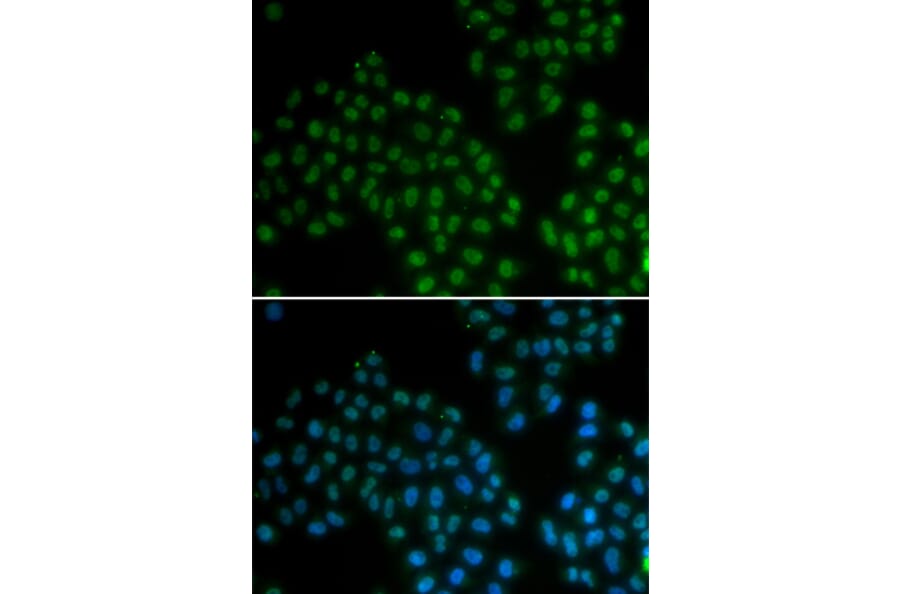 Immunofluorescence - SOX2 antibody from Signalway Antibody (38134) - Antibodies.com