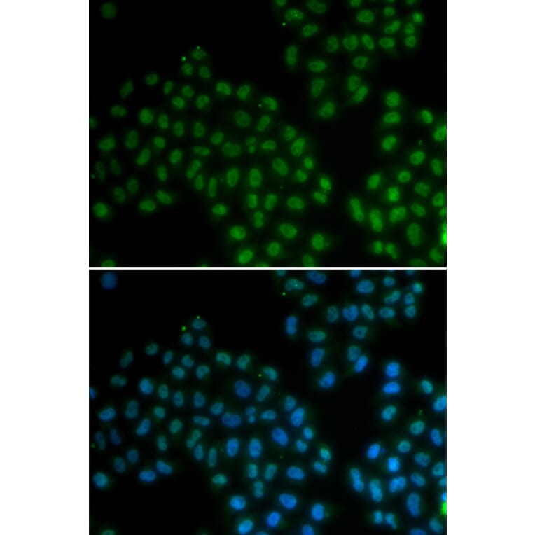 Immunofluorescence - SOX2 antibody from Signalway Antibody (38134) - Antibodies.com