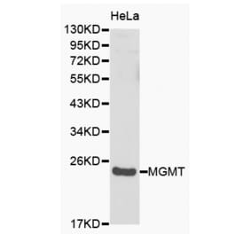 Western blot - MGMT antibody from Signalway Antibody (38149) - Antibodies.com