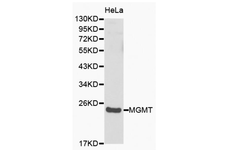Western blot - MGMT antibody from Signalway Antibody (38149) - Antibodies.com
