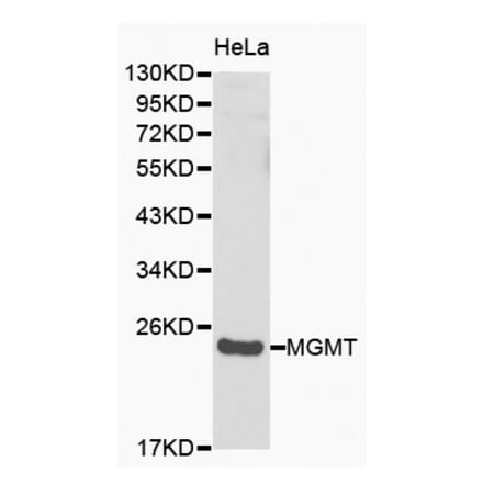 Western blot - MGMT antibody from Signalway Antibody (38149) - Antibodies.com