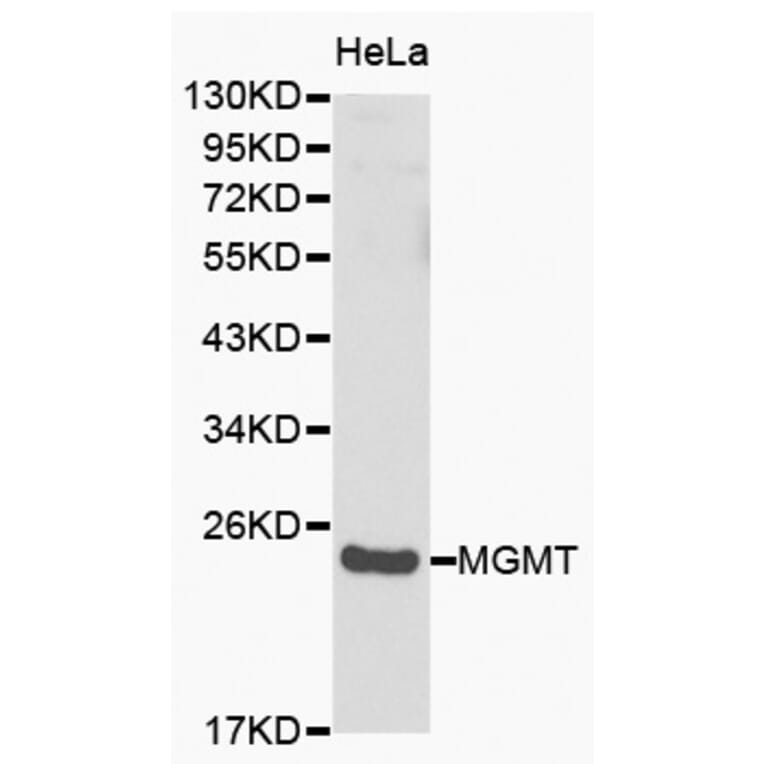 Western blot - MGMT antibody from Signalway Antibody (38149) - Antibodies.com