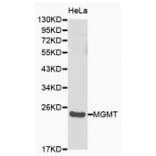 Western blot - MGMT antibody from Signalway Antibody (38149) - Antibodies.com