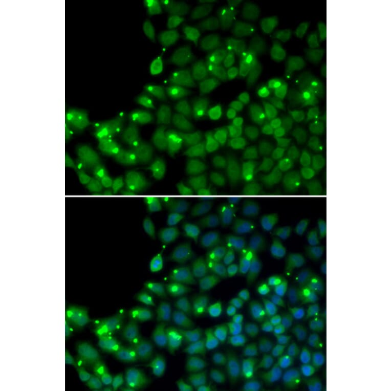 Immunofluorescence - MGMT antibody from Signalway Antibody (38149) - Antibodies.com