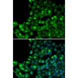 Immunofluorescence - MGMT antibody from Signalway Antibody (38149) - Antibodies.com