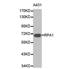 Western blot - RPA1 antibody from Signalway Antibody (38162) - Antibodies.com