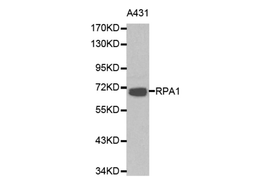 Western blot - RPA1 antibody from Signalway Antibody (38162) - Antibodies.com