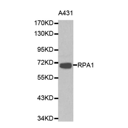 Western blot - RPA1 antibody from Signalway Antibody (38162) - Antibodies.com